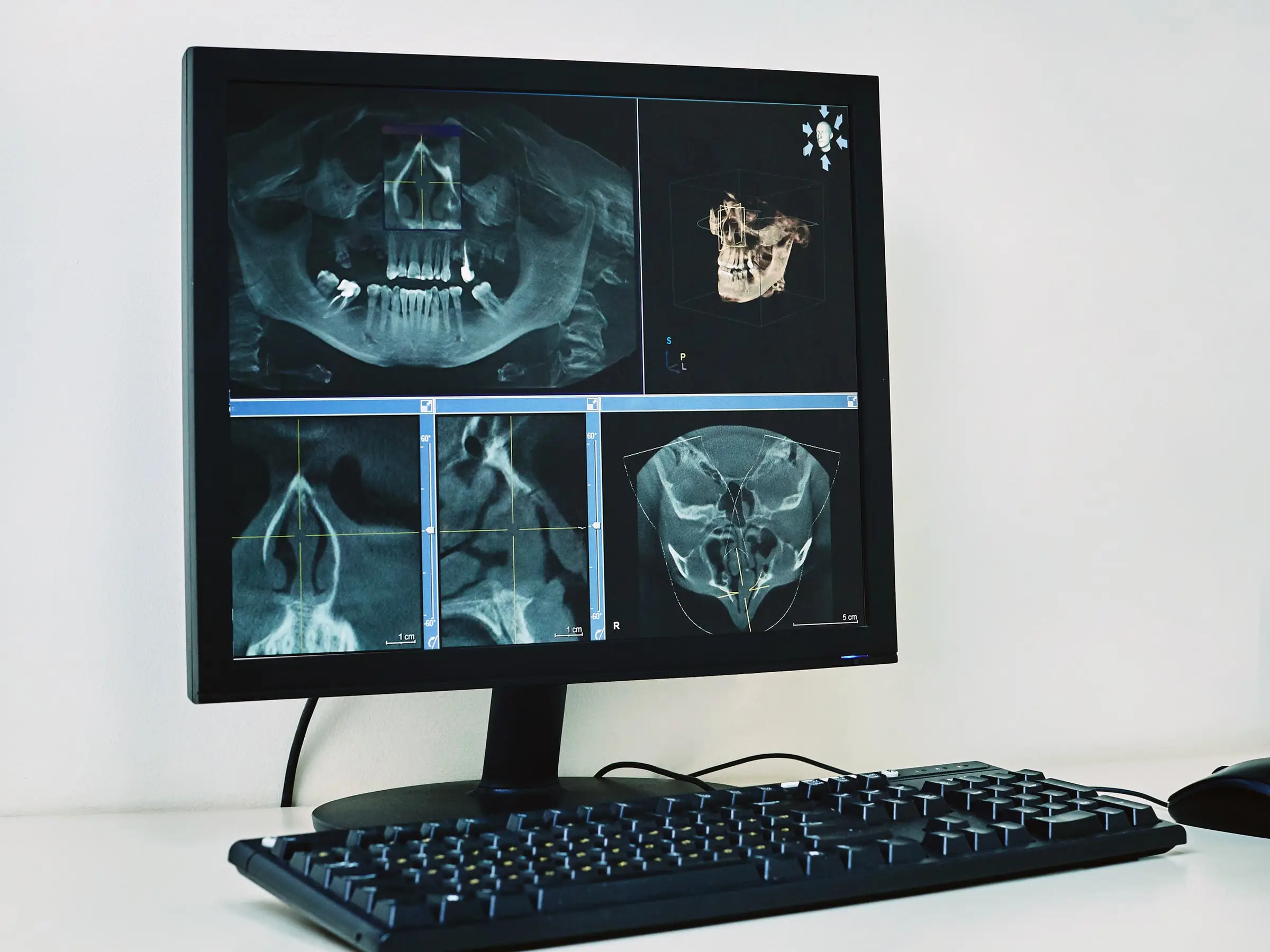 Befundungsmonitor mit DVT-Aufnahme